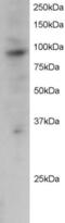 PML antibody, 46-214, ProSci, Enzyme Linked Immunosorbent Assay image 