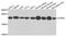 ATP Synthase Peripheral Stalk Subunit D antibody, A4425, ABclonal Technology, Western Blot image 