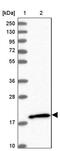 Rho-related GTP-binding protein RhoG antibody, PA5-58958, Invitrogen Antibodies, Western Blot image 