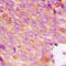 Docking Protein 2 antibody, LS-C353120, Lifespan Biosciences, Immunohistochemistry frozen image 