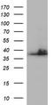 Secretory Carrier Membrane Protein 2 antibody, LS-C338308, Lifespan Biosciences, Western Blot image 