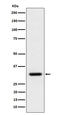 BCL2 Like 12 antibody, M06508, Boster Biological Technology, Western Blot image 