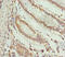 ERLIN2 antibody, LS-C675719, Lifespan Biosciences, Immunohistochemistry paraffin image 