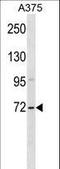 Zinc Finger SWIM-Type Containing 2 antibody, LS-C157529, Lifespan Biosciences, Western Blot image 