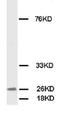 Fibroblast growth factor 8 antibody, AP23341PU-N, Origene, Western Blot image 