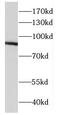 DExD-Box Helicase 21 antibody, FNab02299, FineTest, Western Blot image 