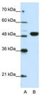 Eukaryotic Translation Initiation Factor 4A2 antibody, TA345787, Origene, Western Blot image 