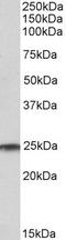 RAN, Member RAS Oncogene Family antibody, TA348979, Origene, Western Blot image 