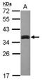 Sulfotransferase 1A3/1A4 antibody, NBP1-31809, Novus Biologicals, Western Blot image 