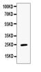 Endothelial Cell Specific Molecule 1 antibody, A04169-1, Boster Biological Technology, Western Blot image 