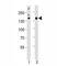 Lysine Demethylase 6B antibody, F52856-0.4ML, NSJ Bioreagents, Western Blot image 