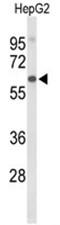 Afamin antibody, AP50105PU-N, Origene, Western Blot image 