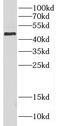 Carboxypeptidase B1 antibody, FNab01916, FineTest, Western Blot image 