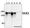 Unc-51 Like Autophagy Activating Kinase 1 antibody, A00584S317, Boster Biological Technology, Western Blot image 