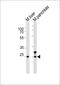Homeobox protein notochord antibody, M05571, Boster Biological Technology, Western Blot image 