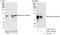 Adducin 3 antibody, A303-716A, Bethyl Labs, Immunoprecipitation image 