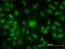 Adenylate kinase isoenzyme 1 antibody, H00000203-M08, Novus Biologicals, Immunocytochemistry image 