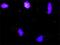 Protein CBFA2T1 antibody, H00000862-D01P, Novus Biologicals, Proximity Ligation Assay image 