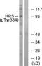 Hepatocyte Growth Factor-Regulated Tyrosine Kinase Substrate antibody, TA312170, Origene, Western Blot image 