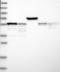 Ring Finger Protein 207 antibody, NBP1-88495, Novus Biologicals, Western Blot image 
