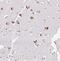 Replication Termination Factor 2 antibody, NBP2-30645, Novus Biologicals, Immunohistochemistry paraffin image 