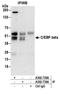 CCAAT Enhancer Binding Protein Beta antibody, A302-739A, Bethyl Labs, Immunoprecipitation image 