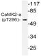 Calcium/Calmodulin Dependent Protein Kinase II Alpha antibody, AP20879PU-N, Origene, Western Blot image 