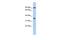 Leucine Rich Repeat Containing 73 antibody, GTX45424, GeneTex, Western Blot image 