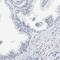 NKG2D ligand 1 antibody, HPA007547, Atlas Antibodies, Immunohistochemistry frozen image 