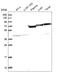 Histone acetyltransferase KAT2A antibody, HPA048958, Atlas Antibodies, Western Blot image 