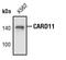 Caspase Recruitment Domain Family Member 11 antibody, MA5-15037, Invitrogen Antibodies, Western Blot image 