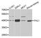 Four And A Half LIM Domains 1 antibody, A5460, ABclonal Technology, Western Blot image 
