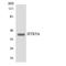 5-Hydroxytryptamine Receptor 5A antibody, LS-C292080, Lifespan Biosciences, Western Blot image 