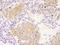 Chaperonin Containing TCP1 Subunit 8 antibody, A303-446A, Bethyl Labs, Immunohistochemistry paraffin image 