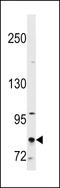 Cutaneous T Cell Lymphoma-Associated Antigen 1 antibody, LS-C157667, Lifespan Biosciences, Western Blot image 