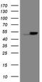 Epoxide Hydrolase 1 antibody, TA800408, Origene, Western Blot image 