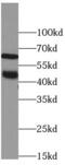 Somatostatin Receptor 1 antibody, FNab08252, FineTest, Western Blot image 