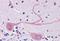 Mesencephalic Astrocyte Derived Neurotrophic Factor antibody, MBS242565, MyBioSource, Immunohistochemistry paraffin image 