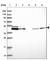 DEAD-Box Helicase 49 antibody, HPA048093, Atlas Antibodies, Western Blot image 