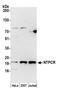 Nucleoside-Triphosphatase, Cancer-Related antibody, A305-696A-M, Bethyl Labs, Western Blot image 