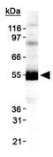 Diacylglycerol O-acyltransferase 1 antibody, GTX48577, GeneTex, Western Blot image 