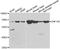 Zinc Finger Protein 195 antibody, A7347, ABclonal Technology, Western Blot image 