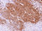 Adenine Phosphoribosyltransferase antibody, LS-C186084, Lifespan Biosciences, Immunohistochemistry paraffin image 