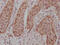 Jun Proto-Oncogene, AP-1 Transcription Factor Subunit antibody, CSB-RA911286A0HU, Cusabio, Immunohistochemistry paraffin image 