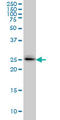 SPRY domain-containing SOCS box protein 2 antibody, LS-B4541, Lifespan Biosciences, Western Blot image 