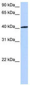 Nuclear Receptor Subfamily 1 Group H Member 3 antibody, TA343558, Origene, Western Blot image 