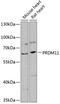 PR/SET Domain 11 antibody, A11092, Boster Biological Technology, Western Blot image 