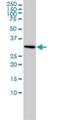 Small Nuclear Ribonucleoprotein Polypeptide A antibody, H00006626-M01, Novus Biologicals, Western Blot image 