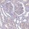 CD38 Molecule antibody, HPA052381, Atlas Antibodies, Immunohistochemistry frozen image 