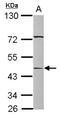 Serpin Family A Member 12 antibody, NBP2-15117, Novus Biologicals, Western Blot image 